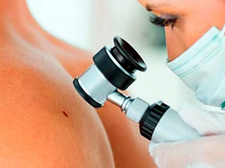 Dermatología en Quito